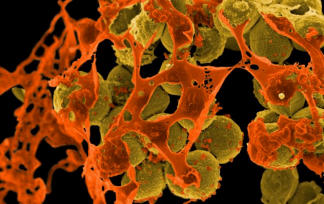Bacteria from Wikipedia